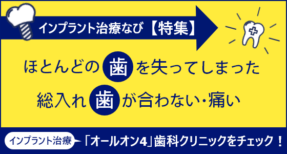 オールオン4について