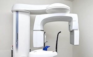 アスティ口腔科歯科クリニックの歯科用CT