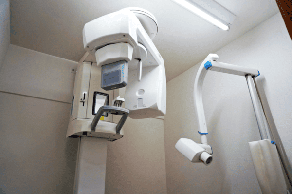 インプラントの精密検査で活用される歯科用CT