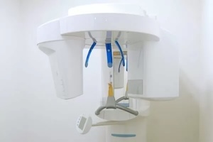 歯科用CT